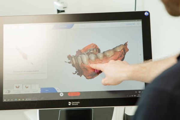 DVT Aufnahme für eine sichere Durchführung von All-on-4